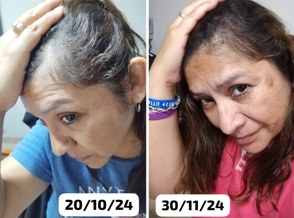 COLAJENO RENOVA DOBLE MENTE HIDROLISADO